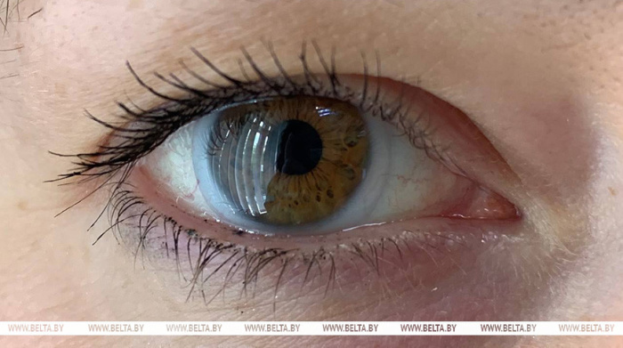 Офтальмолог: Беларусь находится среди лидирующих стран по трансплантации роговицы глаза