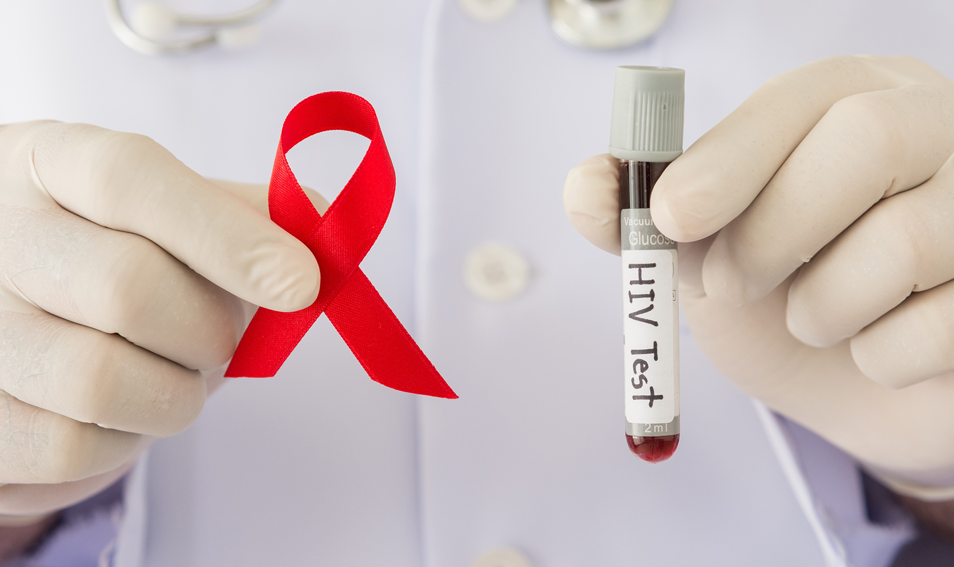 На Гомельщине в январе – апреле выявили 134 новых случая ВИЧ-инфекции